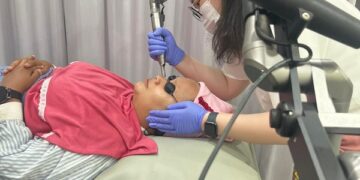 Paparan Matahari Picu Penuaan, dr. Giselle Rekomendasikan Pico Laser