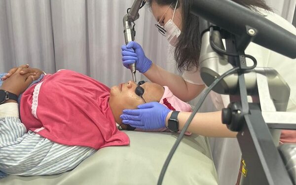 Paparan Matahari Picu Penuaan, dr. Giselle Rekomendasikan Pico Laser