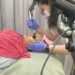 Paparan Matahari Picu Penuaan, dr. Giselle Rekomendasikan Pico Laser